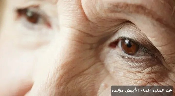 هل عملية الماء الأبيض مؤلمة
