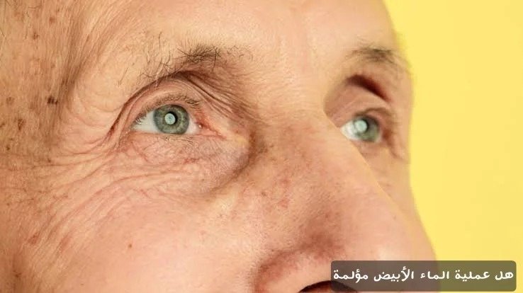 هل عملية الماء الأبيض مؤلمة