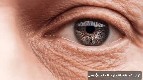 كيف تستعد لعملية الماء الأبيض